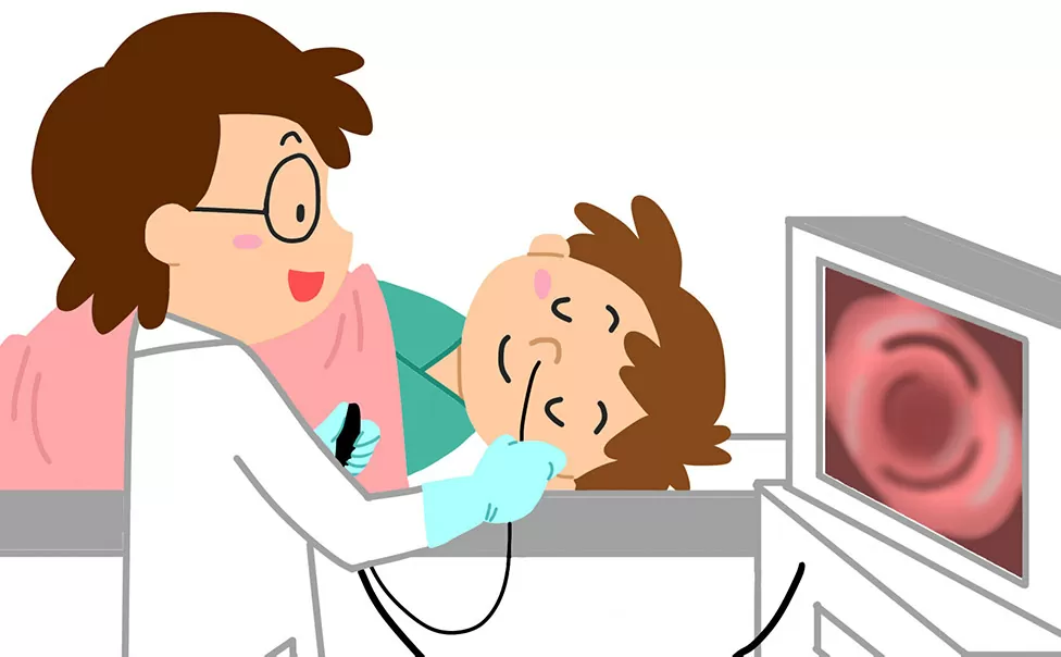 内視鏡検査のイラスト